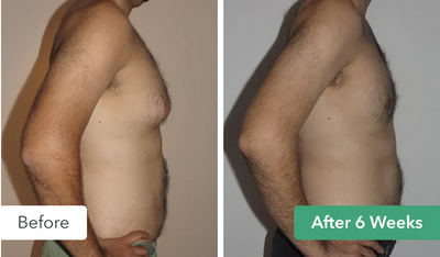 Before and After Transformation